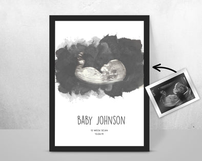 Personalised Baby Scan Ultrasound Watercolour Print