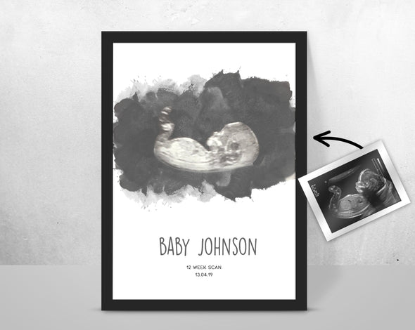 Personalised Baby Scan Ultrasound Watercolour Print