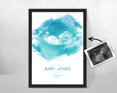 Personalised Baby Scan Ultrasound Watercolour Print