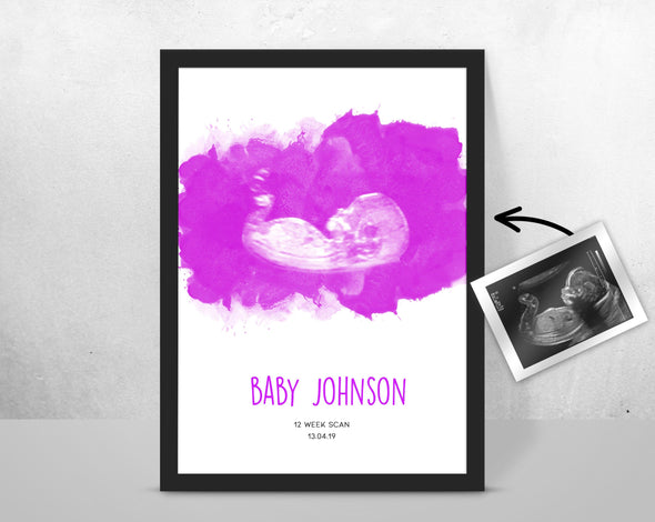 Personalised Baby Scan Ultrasound Watercolour Print