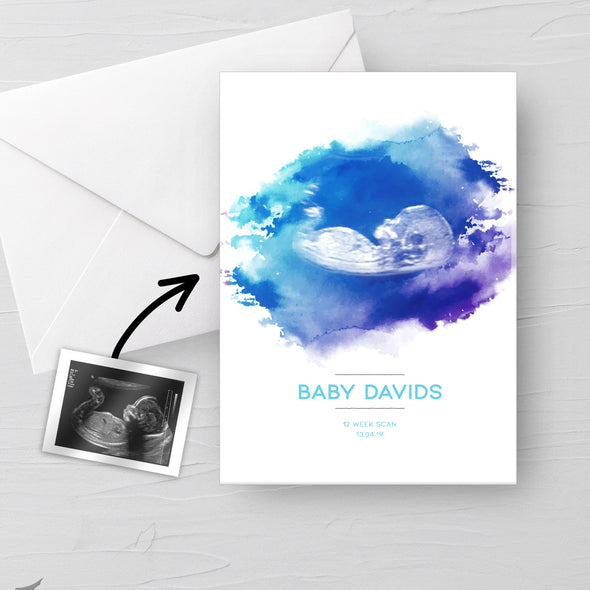Personalised Baby Scan Ultrasound Watercolour greeting card