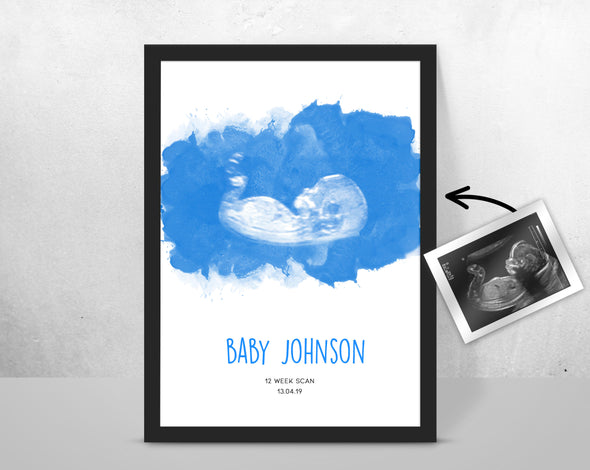 Personalised Baby Scan Ultrasound Watercolour Print