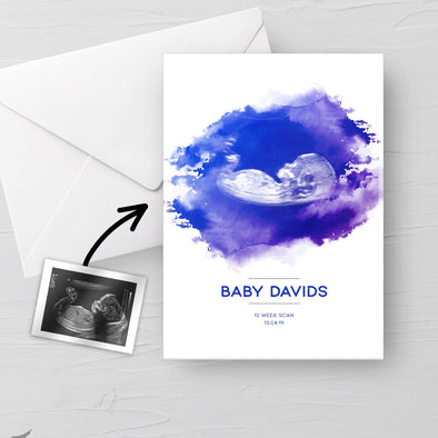 Personalised Baby Scan Ultrasound Watercolour greeting card