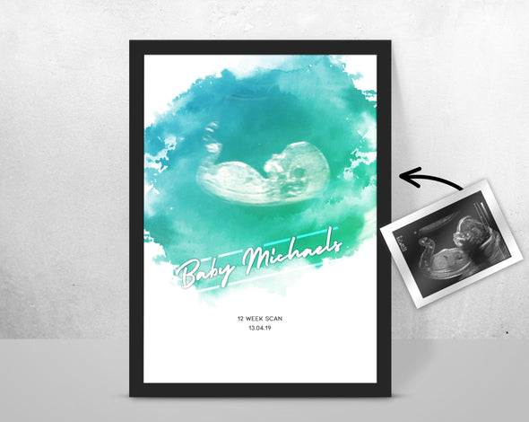 Personalised Baby Scan Ultrasound Watercolour Print